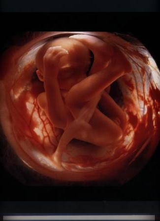 Фото развития плода от зачатия до рождения