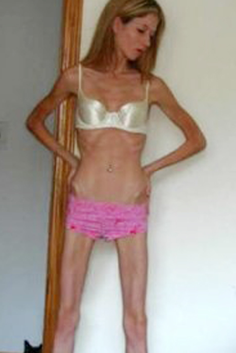 http://www.missfit.ru/photohall/diet/i/25.jpg