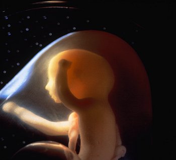 Аборт - последствия аборта, аборт и его последствия
