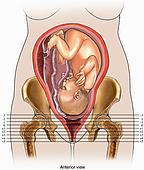 ► Чем грозит узкий таз при родах? Представляем особенности, осложнения родов при анатомически узком тазе!