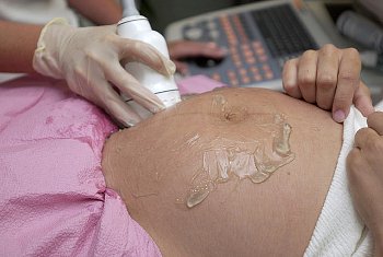 ► Не вредно ли, на каком сроке лучше делать 3D УЗИ при беременности?