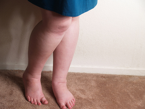 ► Как избавиться от отеков ног во время беременности в домашних условиях