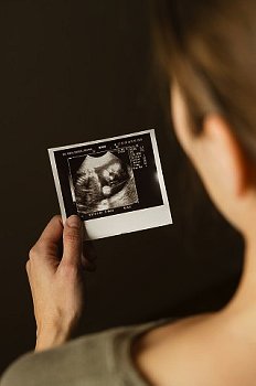 ► Что смотрят на УЗИ на 22 неделе беременности? Представляем показатели норм уз-исследования плода в 22 недели беременности!