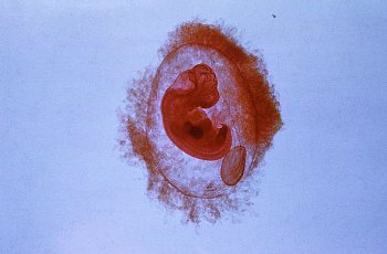Выделения на 6 неделе беременности ► Почему появляются мажущие, коричневые, кровянистые выделения на 6 неделе беременности?
