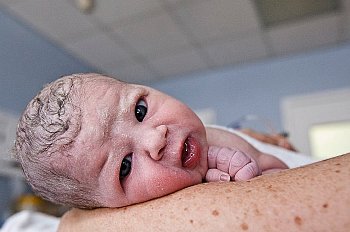 Разрывы шейки матки при родах ► Причины и последствия разрывов шейки матки при родах