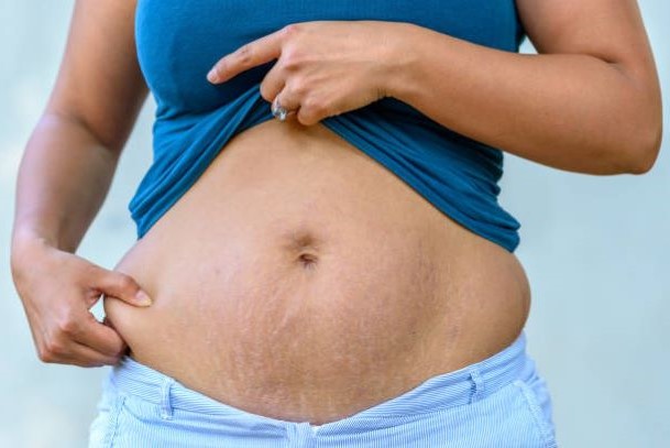 как быстро похудеть после беременности