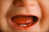 ► Признаки прорезывания первых зубов