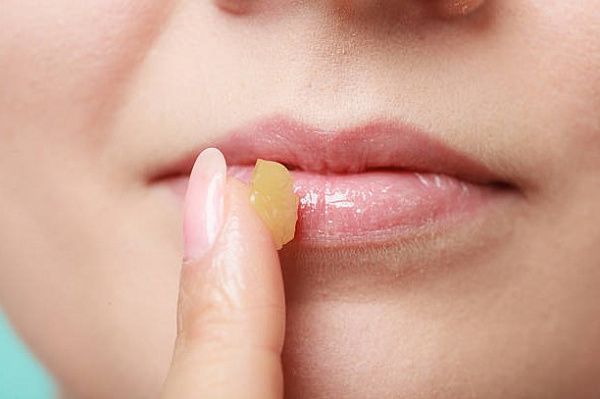 Уход за губами зимой: лучшие советы