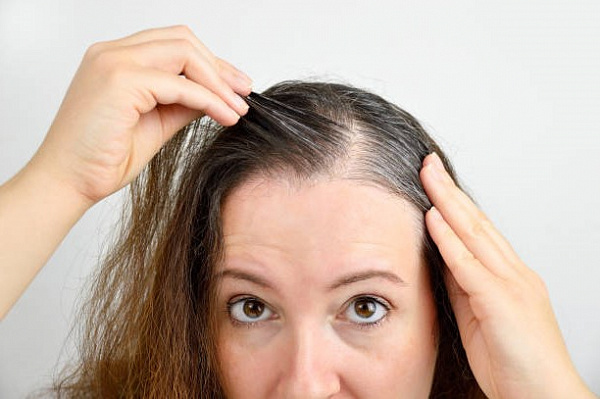 Эти гормональные нарушения сильно портят кожу