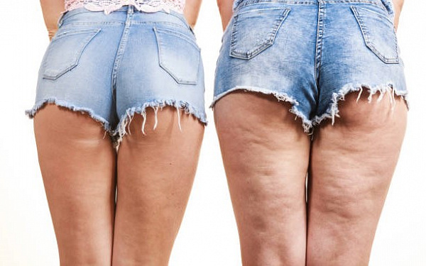 Эти 8 продуктов подтягивают соединительную ткань