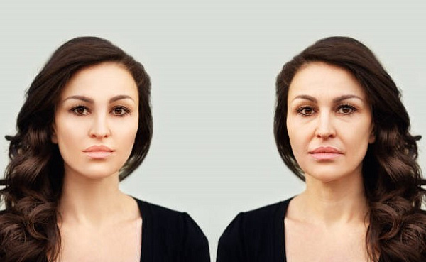 Ботокс или гиалуроновая кислота: что выбрать?