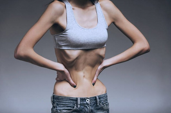 Самые важные сведения об анорексии