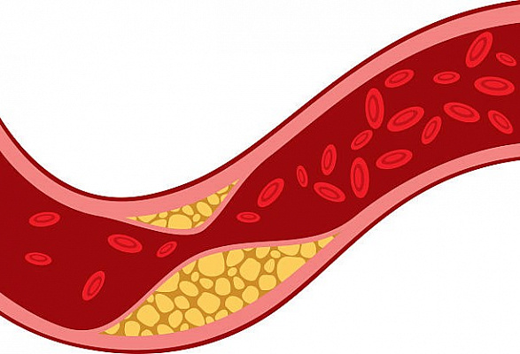 Всё, что вы хотели знать о холестерине: мифы и факты