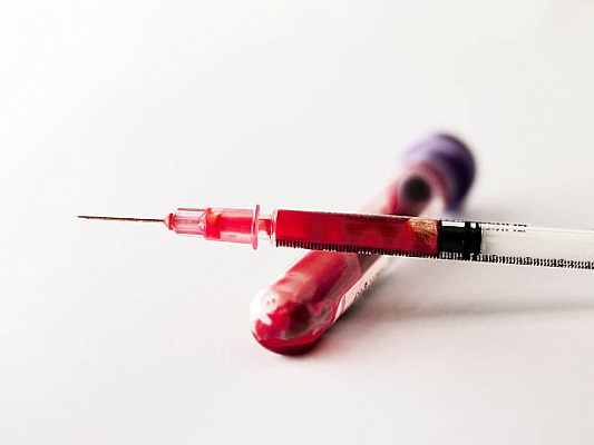 Стань моложе с вампирским лифтингом