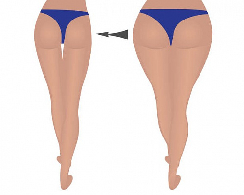 4 способа избавиться от жира на бедрах