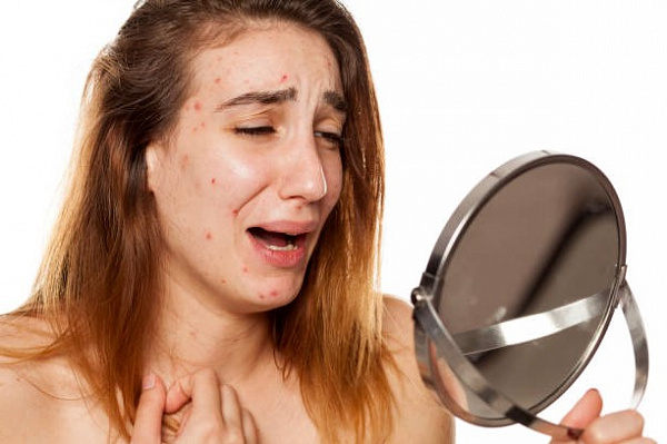 Как вернуть женские гормоны к балансу без лекарств?