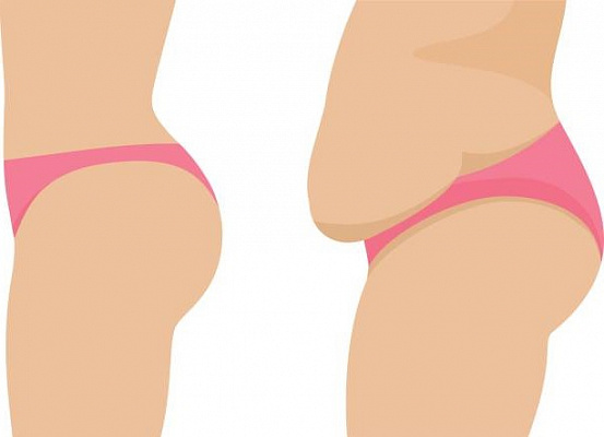 6 способов уменьшить жир на животе без спорта