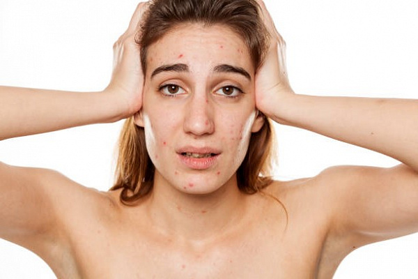 Как ухаживать за жирной кожей?