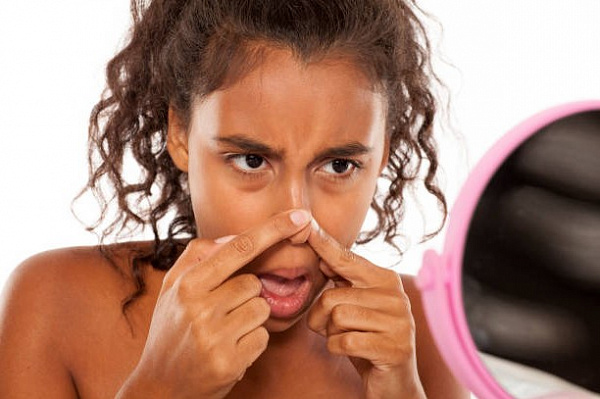 Как избавиться от черных точек