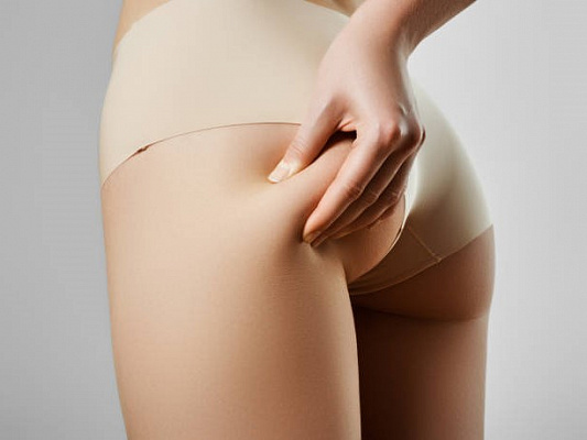 Можно ли похудеть только в проблемных зонах?