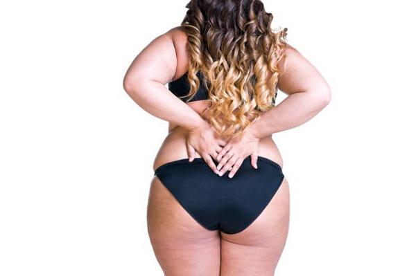 16 ответов на вопросы о целлюлите