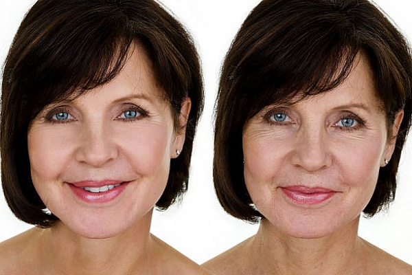 Определи тип морщин и избавься от них