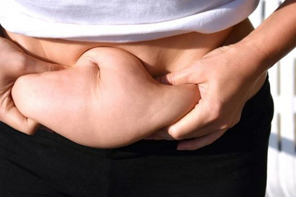 4 способа избежать появления висящей кожи после похудения