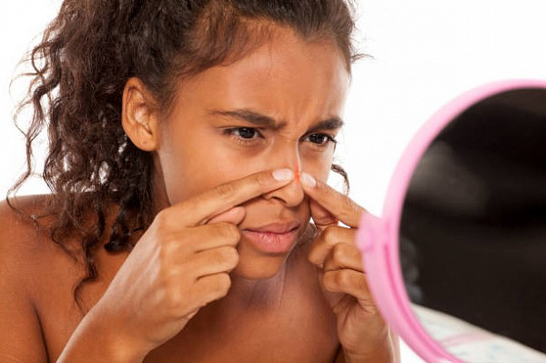 Лучшие способы избавления от черных точек