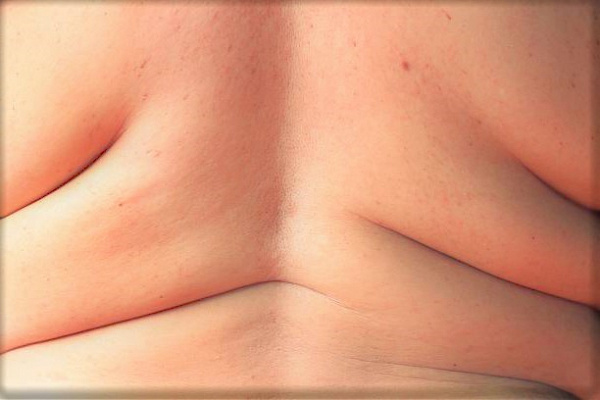 Опасная аптечка, или от каких лекарств полнеют