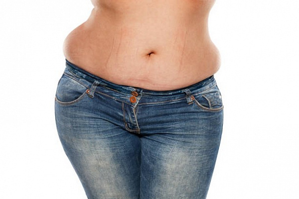 Эти 10 ошибок сильно портят облик женщины