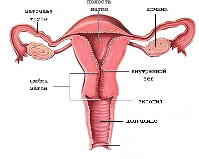 ► Цервикальная эктопия эпителия шейки матки у нерожавших